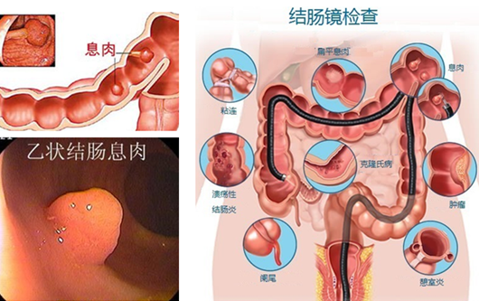 为什么皮股哪里有个肉球